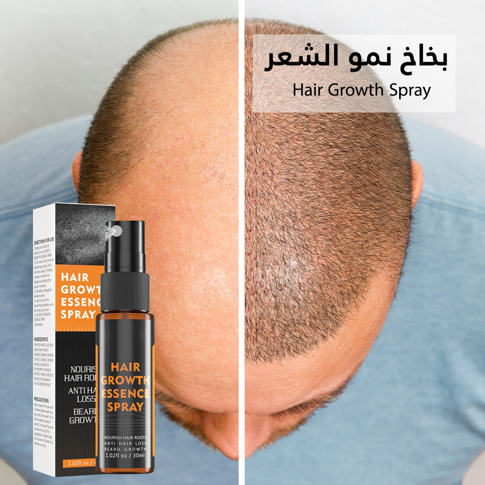 Hair Growth Spray بخاخ نمو الشعر