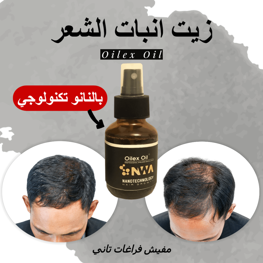 زيت لانبات الشعر والحمايه من الصلع بخصيه النانو تكنولوجي